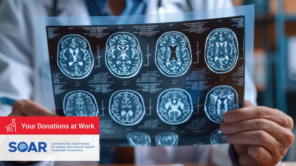 A medical professional examines a MRI image of a human brain